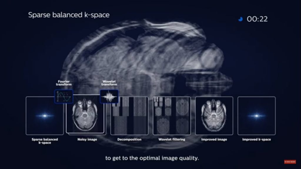 Accelerated Imaging Using Compressed SENSE Neura Imaging