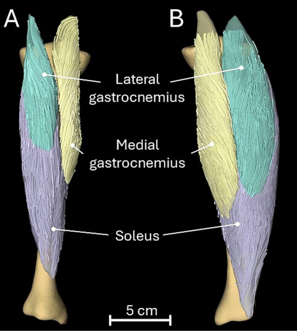 Triceps surae muscle architecture