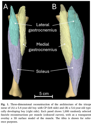 Triceps surae muscle architecture